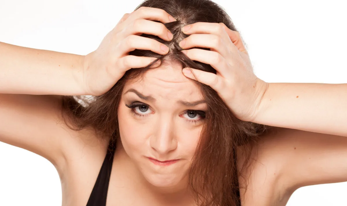 alopecia